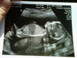 baby girl.jpg