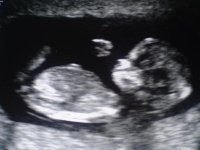 baby apr 2011 002.jpg