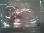 baby.jpg