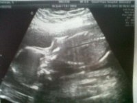 20week scan.jpg