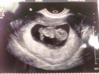 10WEEK1DAY.jpg