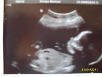 My 20 week scan Ashton Louis (2).jpg