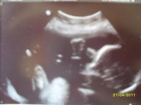 My 20 week scan Ashton Louis (3).jpg