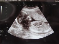 17.5 weeks 2.jpg