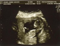 BABY ON 21-04-2011.jpg