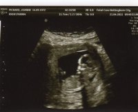 BABY ON 21-04-2011 (3).jpg