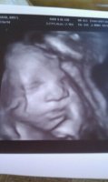 33 weeks (3).jpg