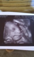 33 weeks (2).jpg