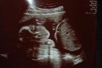 24wks 003.jpg