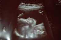 24wks 004.jpg