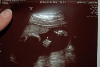 24wks 005.jpg