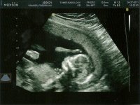 scan0015.jpg