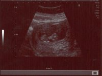 11w pic 1.jpg