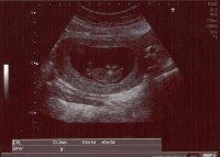 11w pic 2.jpg