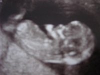 scan at 11+4.jpg