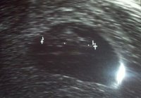 2011-05-05_09-42-29_747.jpg