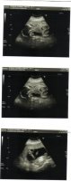 lynnette_scan_20wks[1].jpg