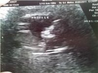 ultrasound5.jpg