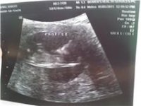 ultrasound6.jpg