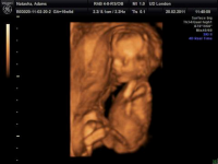 riley rae 4d scan.png