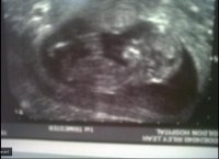 baby scan.jpg
