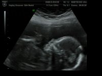 vlcsnap-2011-05-06-19h35m11s96.jpg