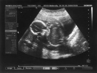 scan.jpg