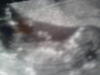 13 wks Baby nub 1.jpg