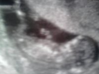 13 wks Baby nub 2.jpg