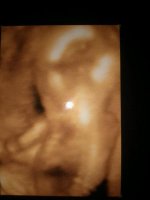 baby girls back.jpg