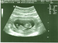 Baby Scan 12 Weeks.jpg