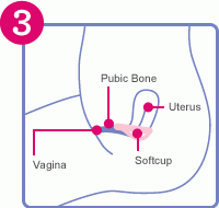 step3.gif