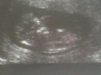 baby 12 weeks.jpg