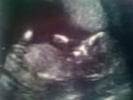 12 week scan (2).jpg