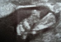 Brieanan Feet 17 weeks.JPG