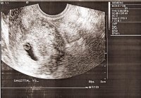 First Scan.jpg