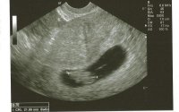 baby2.jpg