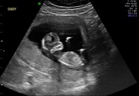 baby1.jpg