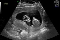 baby3.jpg