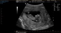 Baby side on.jpg
