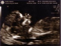 babypic1.jpg