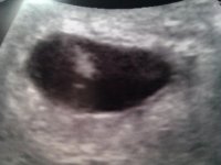 2011-05-23 9.55.21.jpg