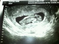 Baby Clifton 05-23-2011.jpg