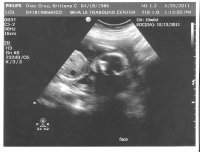 20weekFace.jpg