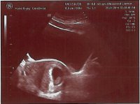 First Scan 1.jpg