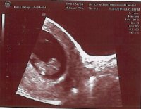 First Scan 4.jpg