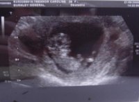 baby pics 005.jpg