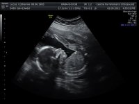 baby_63.jpg