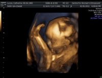 baby_55.jpg