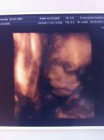 scan4d.jpg